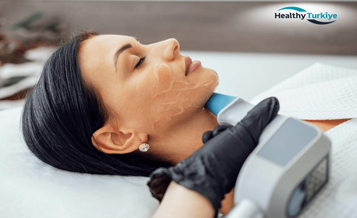 Co2 laser skin resurfacing in turkey